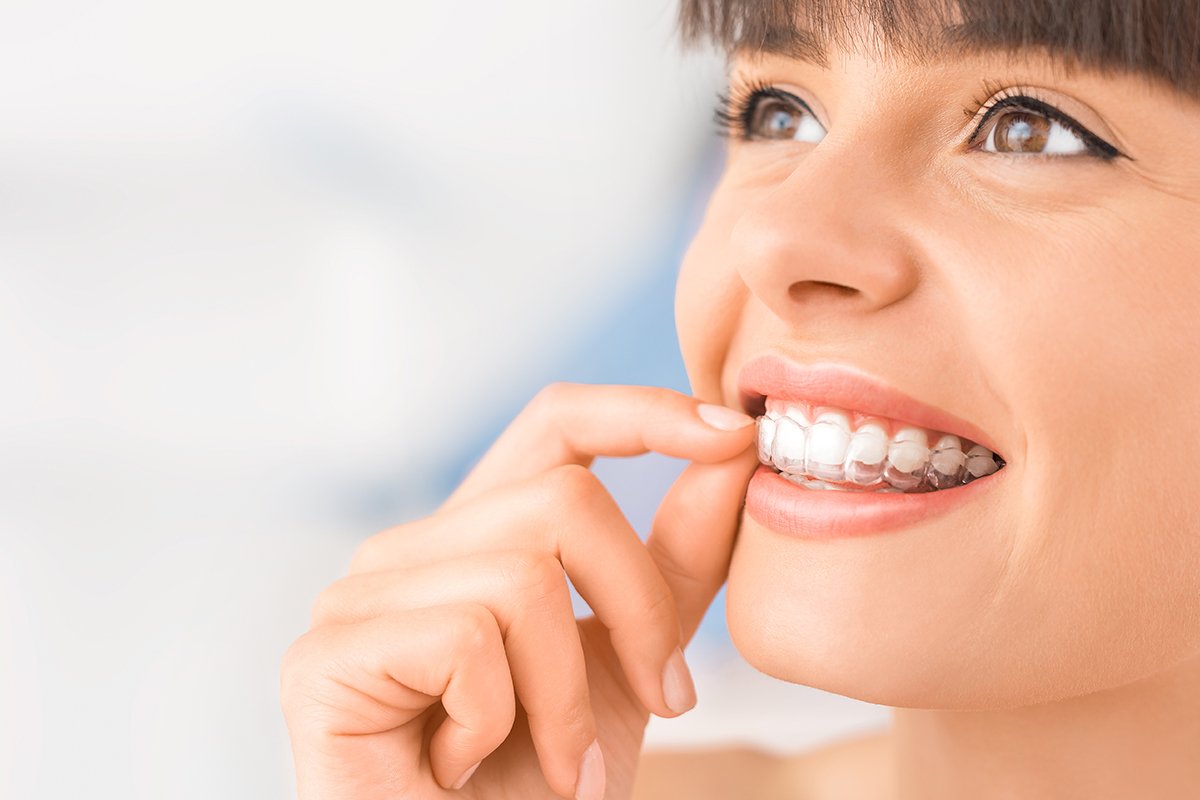 Can I Get Invisible Aligners for Minor Teeth Adjustments in Calgary? Find Out Here!