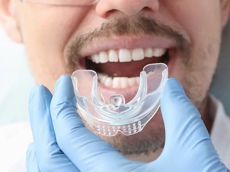 Unveiling the Benefits of Transparent Aligners for Subtle Teeth Straightening